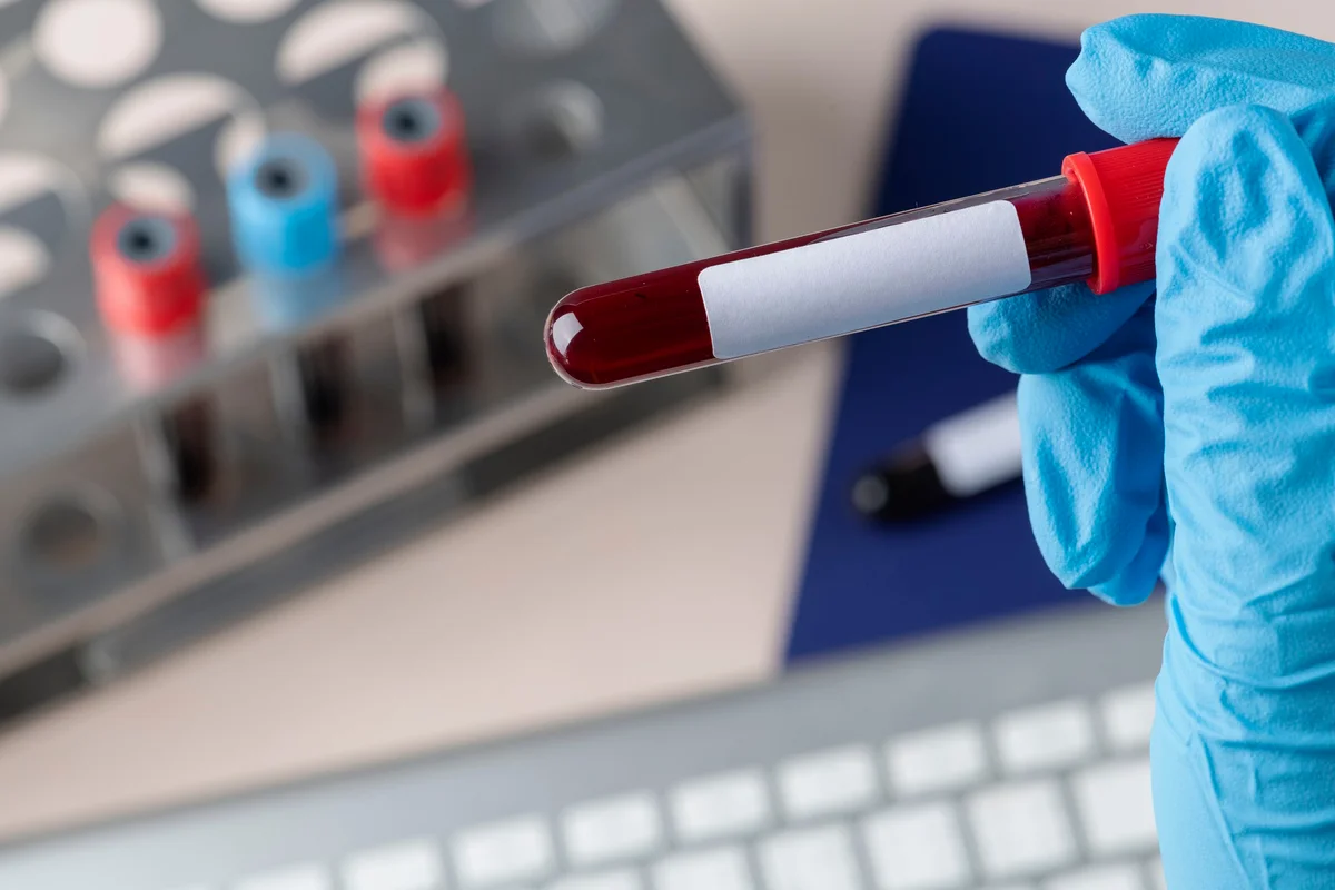 Pregnancy: This Blood Test Could Soon Detect Genetic Diseases in Babies